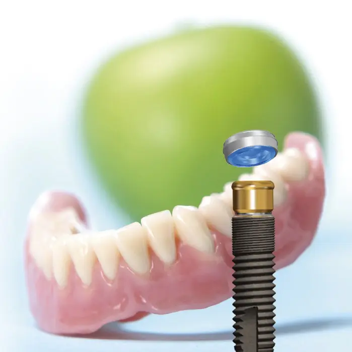 Dental Implants Orpington